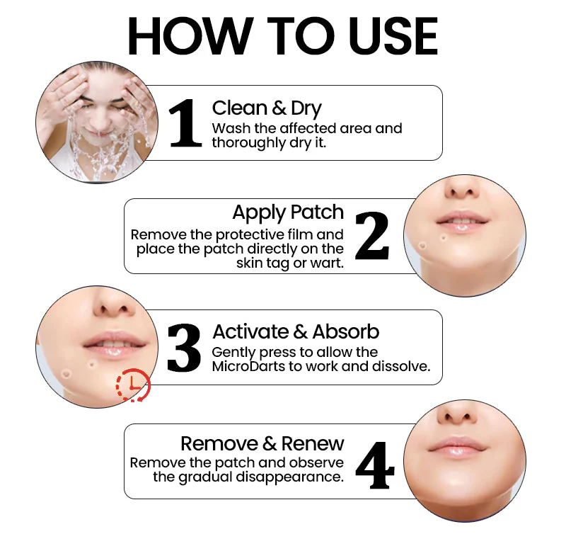 KUBOZN® Pro MicroDarts TAG'Gone Patch - Image 5