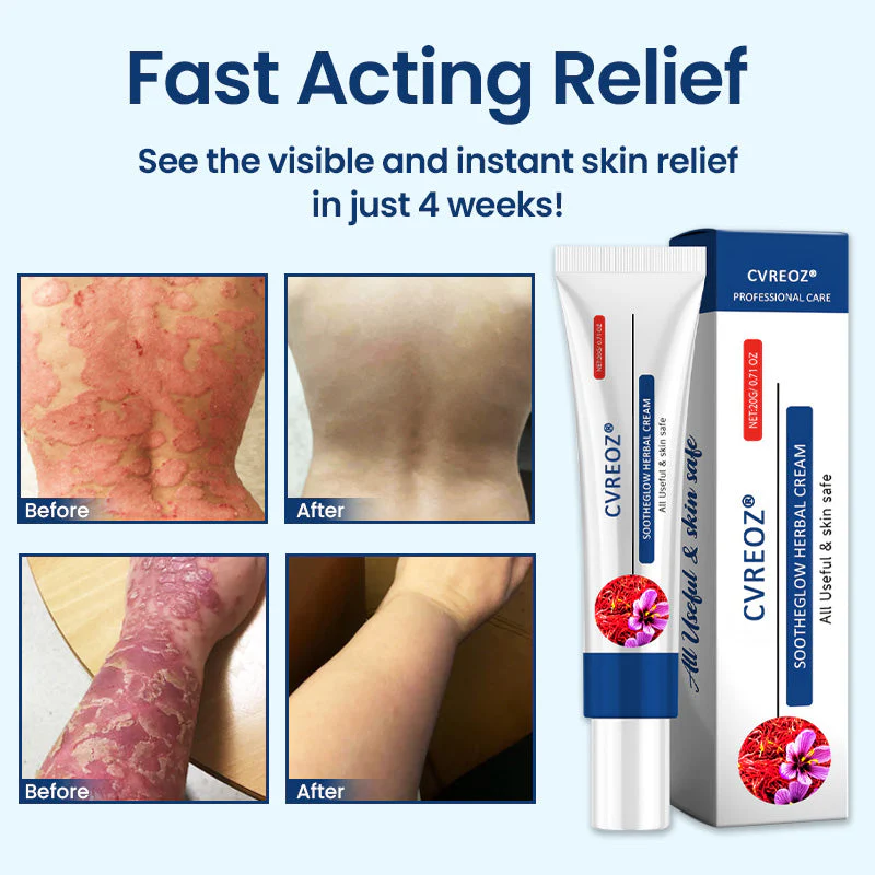 CVREOZ® SootheGlow Herbal Cream - Image 5