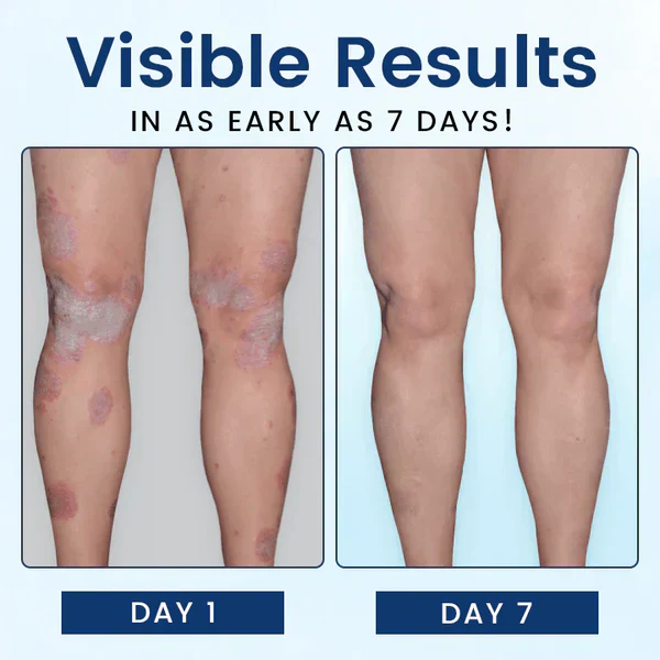 CVREOZ® SootheGlow Herbal Cream - Image 8